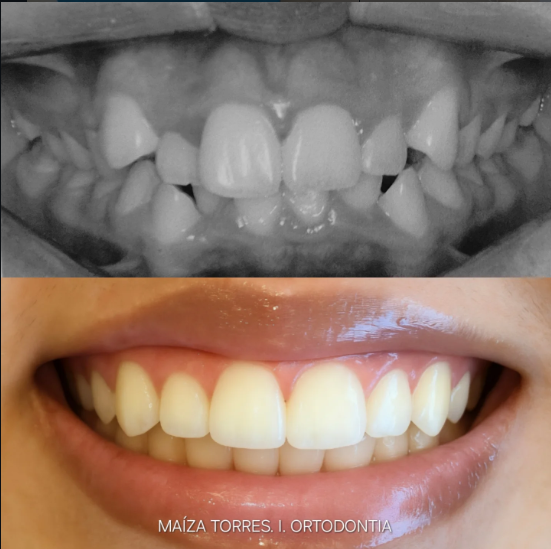 Antes e depois — Dra. Maíza Torres